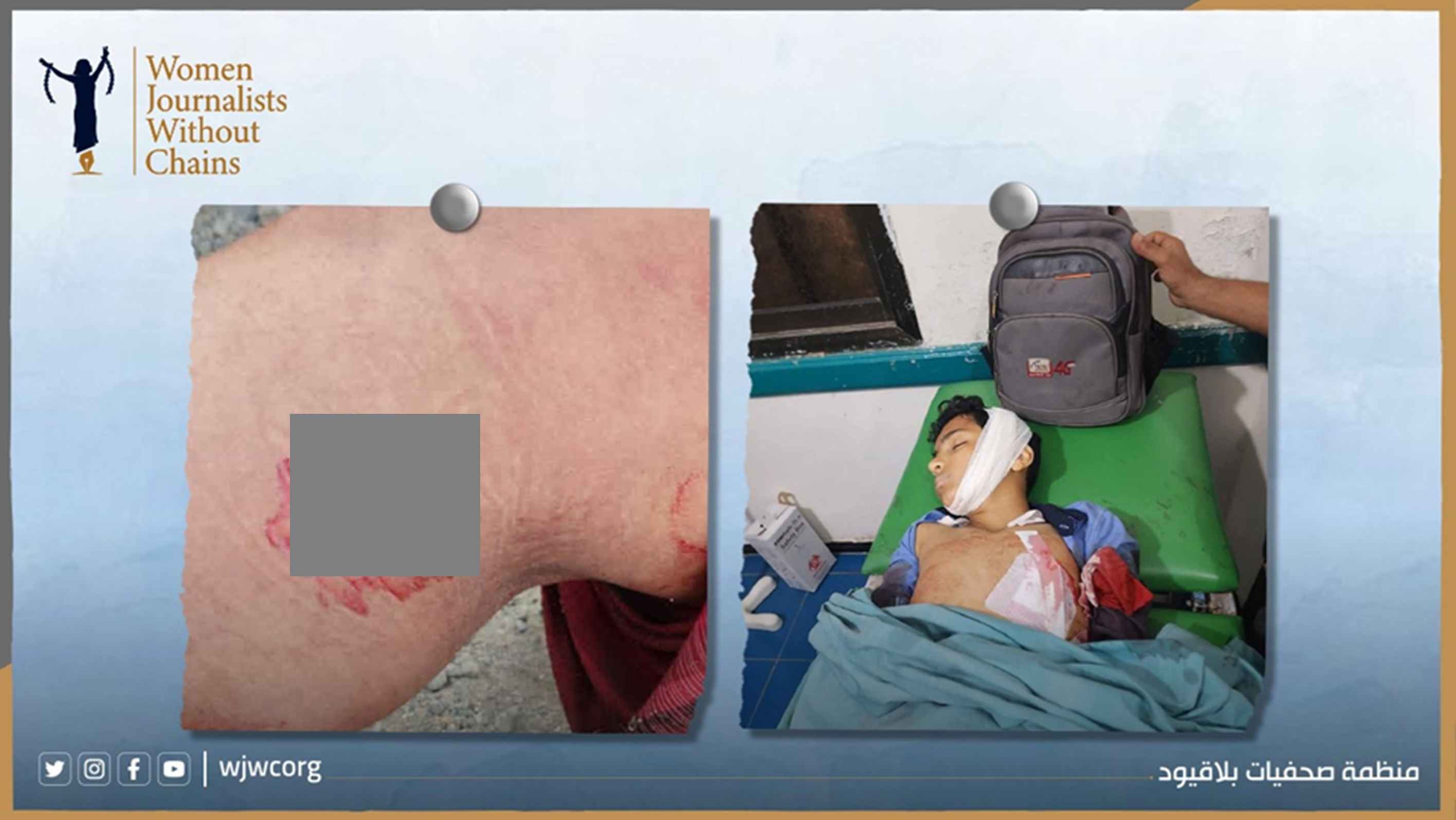 اليمن: مليشيا الحوثي تواصل ارتكاب جرائم حرب ممنهجة بحق المدنيين في تعز